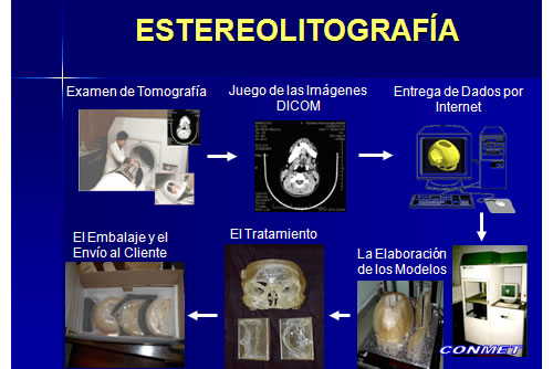 Neurocirugía